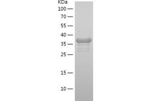 Western Blotting (WB) image for Replication Protein A2, 32kDa (RPA2) (AA 81-217) protein (His-IF2DI Tag) (ABIN7124826)