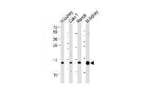 All lanes : Anti-ATP6V1G3 Antibody (N-Term) at 1:2000 dilution Lane 1: Human kidney lysate Lane 2: Caki-1 whole cell lysate Lane 3: Renca whole cell lysate Lane 4: Mouse kidney lysate Lysates/proteins at 20 μg per lane. (ATP6V1G3i 抗体  (AA 15-49))
