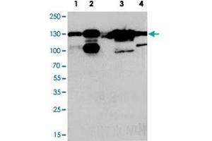 Western blot analysis of whole cell extracts with THBS2 polyclonal antibody . (Thrombospondin 2 抗体  (Middle Region))