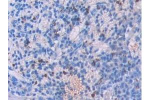 Detection of UCN3 in Mouse Spleen Tissue using Polyclonal Antibody to Urocortin 3 (UCN3) (UCN3 抗体  (AA 24-149))