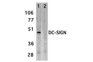 Western Blotting (WB) image for anti-CD209 (CD209) (Extracellular Domain) antibody (ABIN1030833) (DC-SIGN/CD209 抗体  (Extracellular Domain))