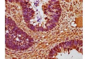 Immunohistochemistry (IHC) image for anti-Cyclin D2 (CCND2) (AA 1-289) antibody (ABIN7153389)