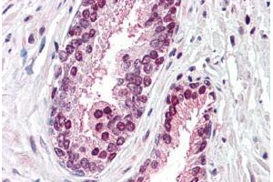 Anti-CDCP1 antibody  ABIN960755 IHC staining of human prostate. (CDCP1 抗体  (Internal Region))