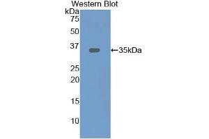 Detection of Recombinant LOX1, Rat using Polyclonal Antibody to Lectin Like Oxidized Low Density Lipoprotein Receptor 1 (LOX1) (OLR1 抗体  (AA 51-314))