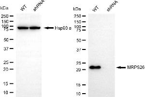 anti-Mitochondrial Ribosomal Protein S26 (MRPS26) antibody