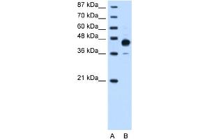 WB Suggested Anti-HOXC10 Antibody Titration:  0.