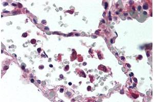 Human Lung (formalin-fixed, paraffin-embedded) stained with TNF antibody ABIN305730 at 2. (TNF alpha 抗体)