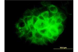 Immunofluorescence of monoclonal antibody to DNAI2 on A-431 cell. (DNAI2 抗体  (AA 1-593))