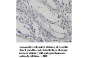 Image no. 1 for anti-Parathymosin (PTMS) (C-Term) antibody (ABIN791017) (Parathymosin 抗体  (C-Term))