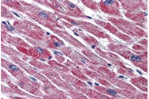 Human Heart: Formalin-Fixed, Paraffin-Embedded (FFPE) (DLD 抗体  (AA 1-510))