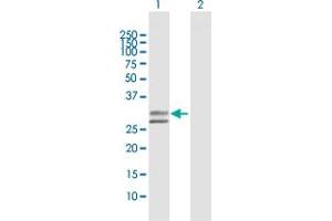 Western Blot analysis of UGCGL2 expression in transfected 293T cell line by UGCGL2 MaxPab polyclonal antibody.