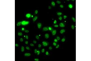 Immunofluorescence analysis of U2OS cells using PMS2 antibody. (PMS2 抗体)