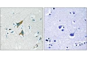 Immunohistochemistry analysis of paraffin-embedded human brain tissue, using MKP1 (Ab-359) Antibody. (DUSP1 抗体  (AA 318-367))