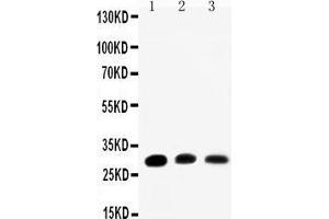 Anti-Aquaporin 1 antibody, Western blotting Lane 1: Rat Kidney Tissue Lysate Lane 2: Rat Lung Tissue Lysate Lane 3: SMMC Cell Lysate (Aquaporin 1 抗体  (C-Term))