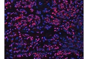 IF analysis of UBC12/UBE2M using anti-UBC12/UBE2M antibody (ABIN7600885). (UBE2M 抗体  (AA 25-154))