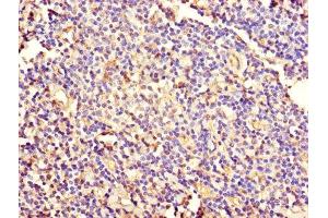 Immunohistochemistry of paraffin-embedded human tonsil tissue using ABIN7157424 at dilution of 1:100 (KRT4 抗体  (AA 1-534))