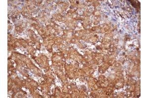 Image no. 2 for anti-Proteasome Subunit alpha 2 (PSMA2) (AA 50-234) antibody (ABIN1491566) (PSMA2 抗体  (AA 50-234))