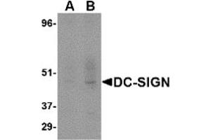 Western Blotting (WB) image for anti-CD209 (CD209) (Extracellular Domain) antibody (ABIN492510) (DC-SIGN/CD209 抗体  (Extracellular Domain))