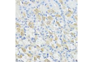 Immunohistochemistry of paraffin-embedded mouse stomach using GPX2 antibody (ABIN7267435) at dilution of 1:100 (40x lens).