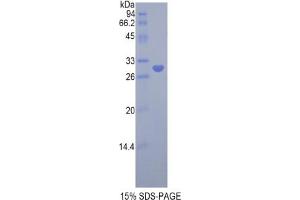 SDS-PAGE analysis of Rat LRPAP1 Protein. (LRPAP1 蛋白)