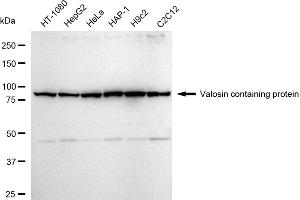Western blotting analysis using Valosin containing protein antibody (ABIN7800818).