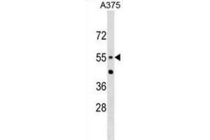 Western Blotting (WB) image for anti-Carnosine Dipeptidase 1 (Metallopeptidase M20 Family) (CNDP1) antibody (ABIN2999631) (CNDP1 抗体)