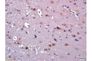 Formalin-fixed and paraffin embedded rat brain labeled with Anti-ABAT Polyclonal Antibody, Unconjugated (ABIN705641) at 1:200 followed by conjugation to the secondary antibody and DAB staining