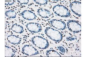 Image no. 2 for anti-Polo-Like Kinase 1 (PLK1) antibody (ABIN1500283) (PLK1 抗体)