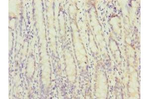 Immunohistochemistry of paraffin-embedded human small intestine tissue using ABIN7172730 at dilution of 1:100