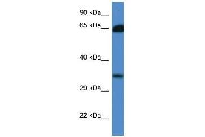 Western Blot showing MGC3207 antibody used at a concentration of 1. (MRI1 抗体  (N-Term))