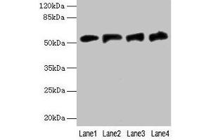 Western blot All lanes: FDXR antibody at 6 μg/mL Lane 1: A549 whole cell lysate Lane 2: Mouse liver tissue Lane 3: HepG2 whole cell lysate Lane 4: U251 whole cell lysate Secondary Goat polyclonal to rabbit IgG at 1/10000 dilution Predicted band size: 54, 55, 59, 49, 53, 50, 58 kDa Observed band size: 54 kDa (Ferredoxin Reductase 抗体  (AA 33-451))