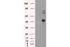 Image no. 8 for anti-Nucleotide Exchange Factor SIL1 (SIL1) antibody (ABIN1496810) (SIL1 抗体)