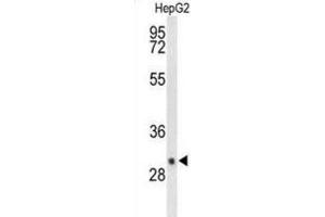 Western Blotting (WB) image for anti-Deiodinase, Iodothyronine, Type III (DIO3) antibody (ABIN3004215) (DIO3 抗体)