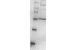 Western Blotting (WB) image for anti-Proteasome (Prosome, Macropain) 26S Subunit, Non-ATPase, 13 (PSMD13) (full length) antibody (ABIN2452116) (PSMD13 抗体  (full length))