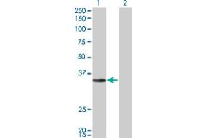 Western Blot analysis of ECH1 expression in transfected 293T cell line by ECH1 monoclonal antibody (M01), clone 5G8. (ECH1 抗体  (AA 21-120))