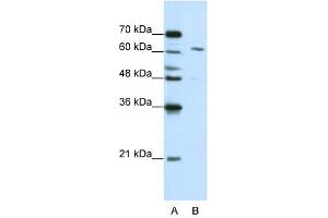 Western Blotting (WB) image for anti-Cleavage and Polyadenylation Specific Factor 6, 68kDa (CPSF6) (Middle Region) antibody (ABIN630020)