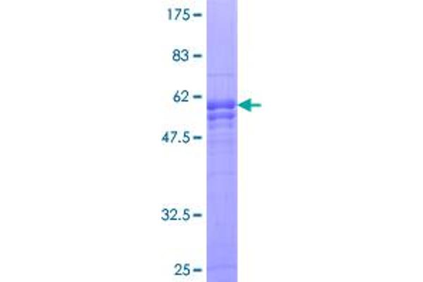 Paxillin Protein (PXN) (AA 1-262) (GST tag)