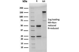 SDS-PAGE Analysis Purified CD23-Monospecific Mouse Monoclonal Antibody (FCER2/3592).