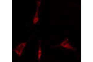 ABIN6275846 staining  293 cells by IF/ICC. (IRAK2 抗体  (Internal Region))