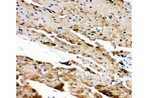IHC analysis of PLN using anti-PLN antibody (ABIN3043442). (Phospholamban 抗体  (N-Term))