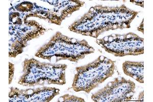 IHC analysis of CSNK2K2 using anti-CSNK2K2 antibody (ABIN7602871).