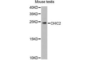 Western blot analysis of extracts of mouse testis, using CHIC2 Antibody (ABIN5974773) at 1/1000 dilution. (CHIC2 抗体)