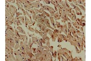 Immunohistochemistry of paraffin-embedded human heart tissue using ABIN7142988 at dilution of 1:100 (ASAH1 抗体  (AA 22-395))