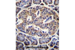 Immunohistochemistry (Paraffin-embedded Sections) (IHC (p)) image for anti-Eukaryotic Translation Initiation Factor 4H (EIF4H) (AA 126-156), (Middle Region) antibody (ABIN952054)