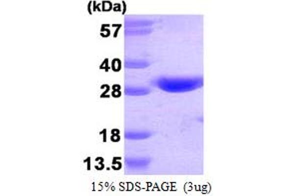 GSTT1 Protein (AA 1-240) (His tag)