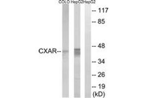 Western blot analysis of extracts from HepG2/COLO cells, using CXADR Antibody. (Coxsackie Adenovirus Receptor 抗体  (AA 1-50))