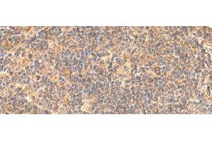 Immunohistochemistry of paraffin-embedded Human tonsil tissue using EIF3K Polyclonal Antibody at dilution of 1:55(x200) (EIF3K 抗体)