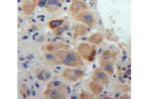 Used in DAB staining on fromalin fixed paraffin-embedded Liver tissue (Cathepsin S 抗体  (AA 123-339))
