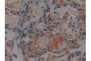 Immunohistochemistry (IHC) image for anti-Protein Kinase C, iota (PRKCI) (AA 375-596) antibody (ABIN7444109)