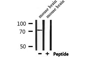 Western Blotting (WB) image for anti-Solute Carrier Family 6 (Neurotransmitter Transporter, Creatine), Member 8 (SLC6A8) (C-Term) antibody (ABIN6259617)